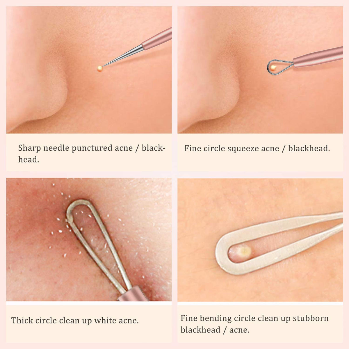 DOCOSS 5 In 1 Stainless Steel Blackhead Remover, Acne & Pimple Removal Acne Needle Tool Set With Metal Case - Rose Gold